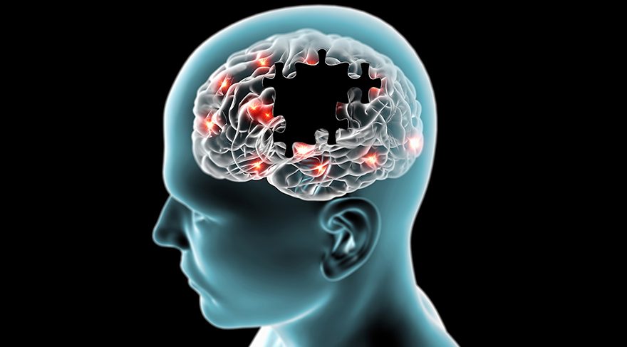 Alzheimer (Unutkanlık) hastalığı nedir? Nöroloji Uzmanı yazdı...