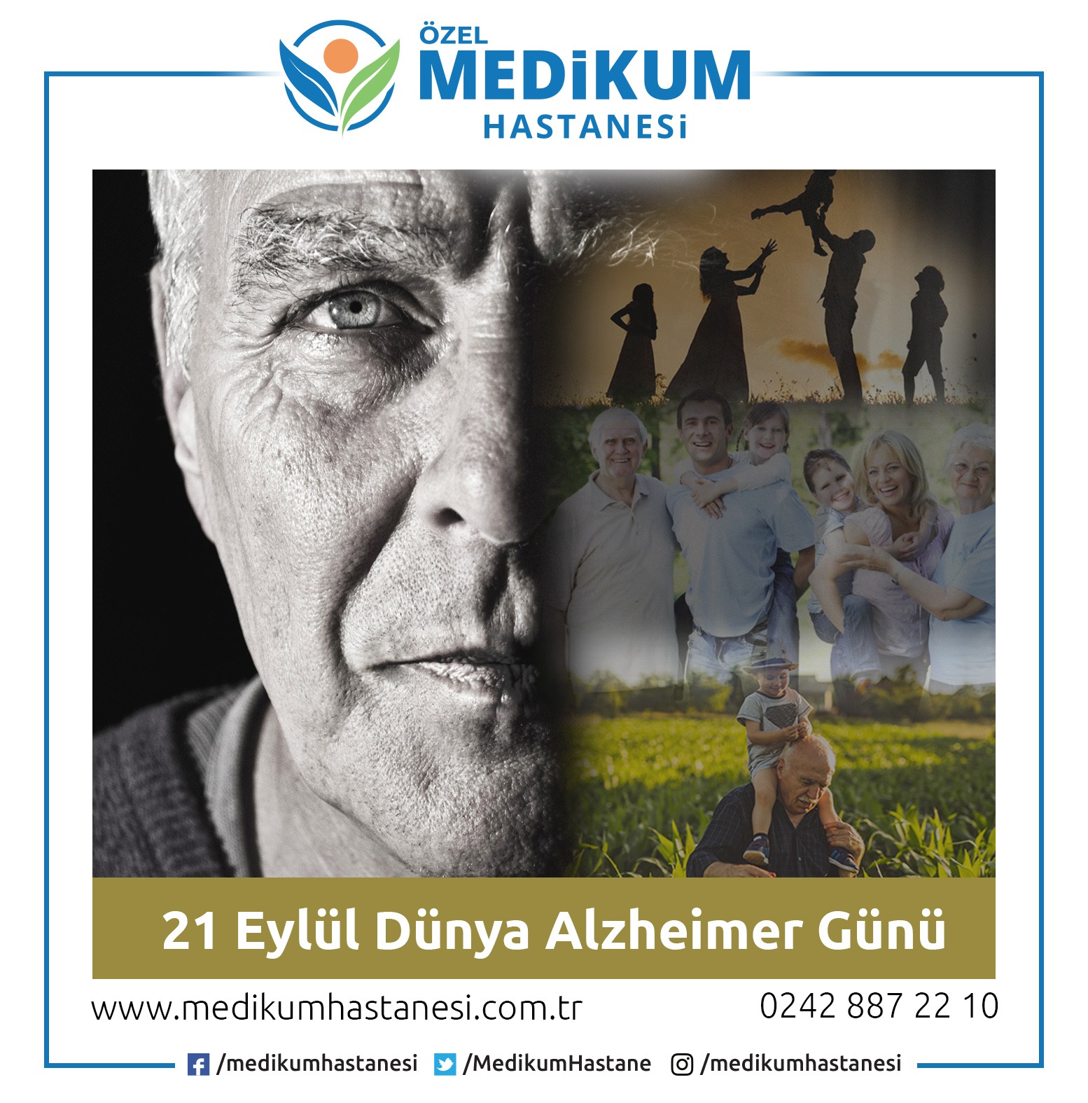 Demans Nedir?